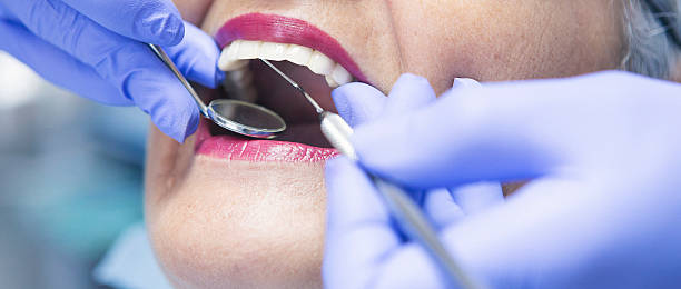 Best Emergency Dental Care for Broken or Chipped Teeth in Clearfield, UT